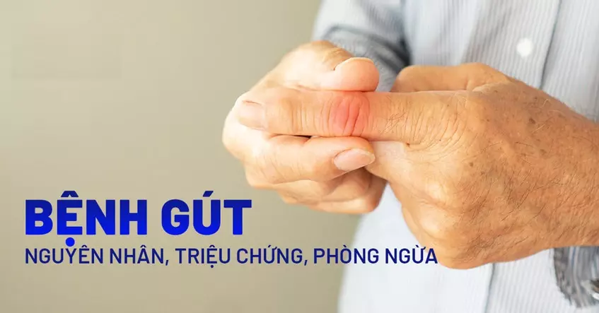Bệnh Gut (Gout)