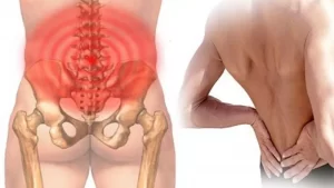 đau vùng mông gần xương cụt