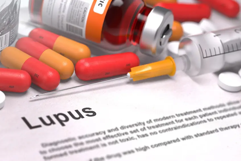 Bệnh lupus ban hệ thống có điều trị được không