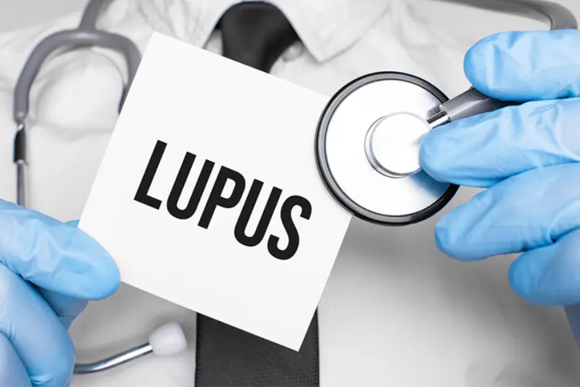 Biến chứng của bệnh lupus ban đỏ 