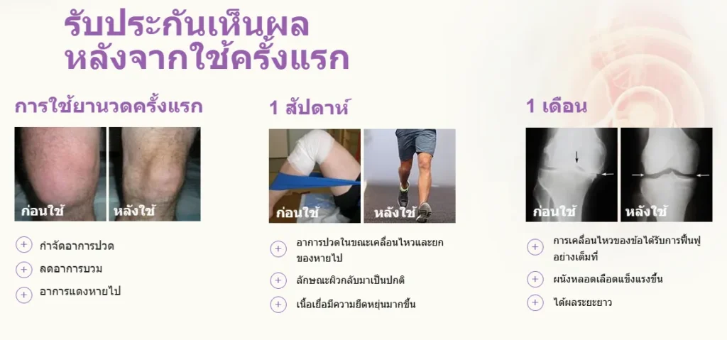 ความรู้สึกหลังใช้ B-Joint Cream จากผู้ใช้จริง