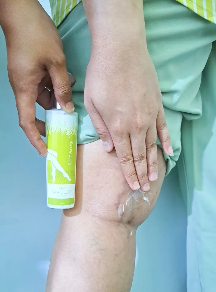 Varicozy Cream